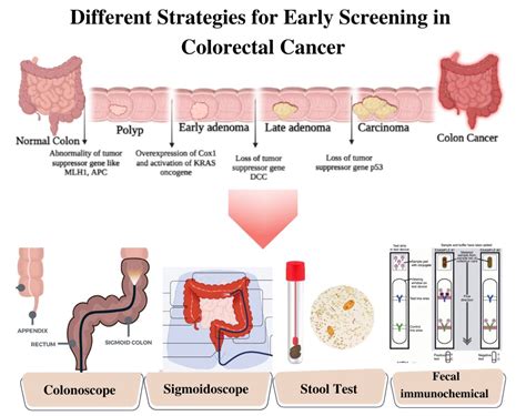 Let S Talk About Colon Cancer Screenings And Bust A Few Myths About Cologuard Myth If I Feel Fine I Don T Need A Colon Cancer Screening Fact Colon Cancer Often Has