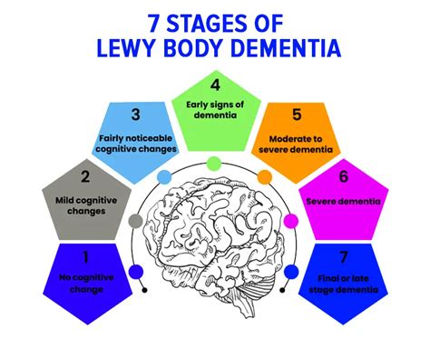 Lewy Body Dementia Specialist Diagnosis Treatment Lewy Body Dementia Specialist Diagnosis Treatment