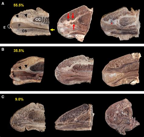 Ligamentous Structures In Human Glans Penis Lee 2019 Journal Of