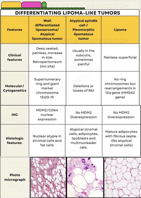 Lipomas Lipoma Variants And Well Differentiated Liposarcomas