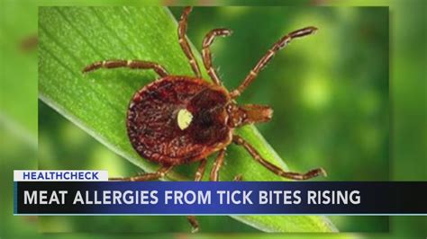 Lone Star Tick Spreading Causes Meat Allergy Lone Star Tick Spreading Causes Meat Allergy