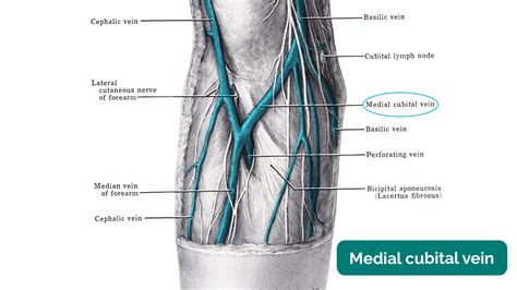 Median Cubital Vein Venipuncture