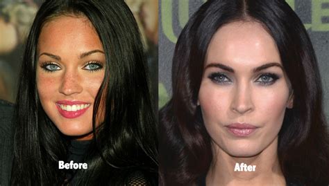Megan Fox Before Surgery
