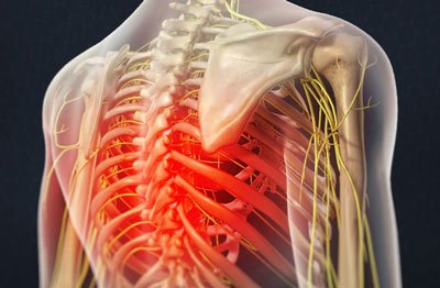 Mid Back Pain Treatment Nyc Middle Back Pain Relief Doctors In New York Mid Back Pain Treatment Nyc Middle Back Pain Relief Doctors In New York