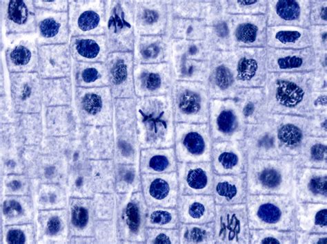 Mitosis Onion Root Tip Lm Stock Image C036 2285 Science Photo