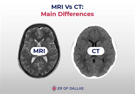 Mri Vs Ct Scan What S The Difference