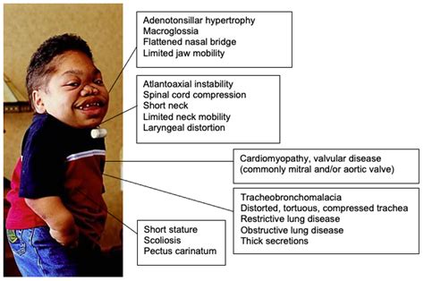 Mucopolysaccharidoses Openanesthesia