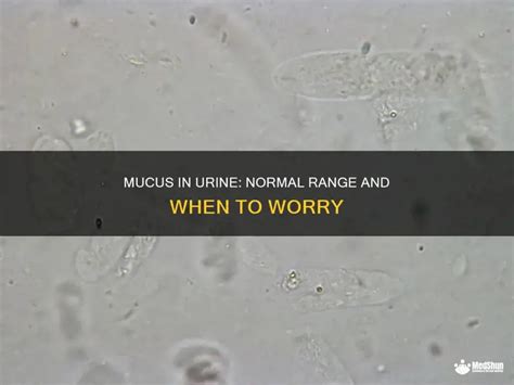 Mucus In Urine Normal Range
