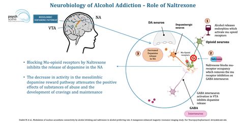 Naltrexone And Alcohol