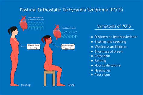 Navigating Postural Orthostatic Tachycardia Syndrome Pots The
