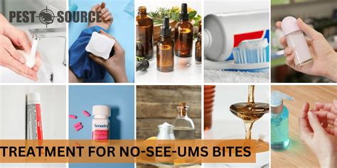 No See Ums Identification Prevention Treatment