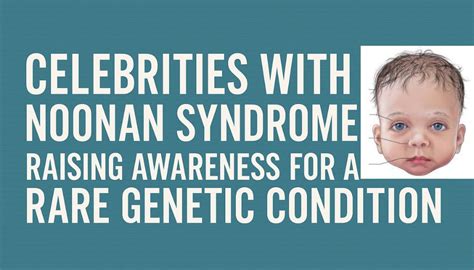 Noonan Syndrome Families Call For Awareness Of Genetic Condition Bbc