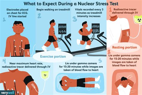 Nuclear Stress Tests Uses Risks And Results
