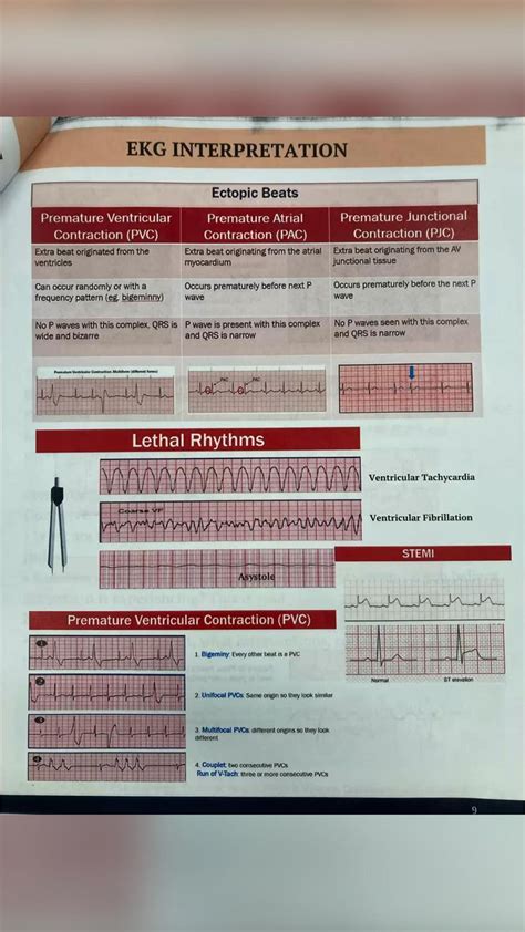 Nursing School Notes Ekg Notes Ekg Tips And Tricks To Help You Pass