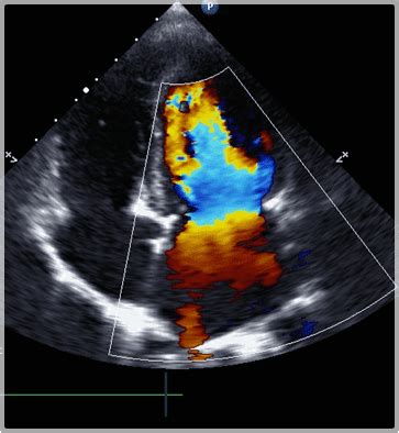 Ocala Family Medical Center Color Flow Doppler Imaging