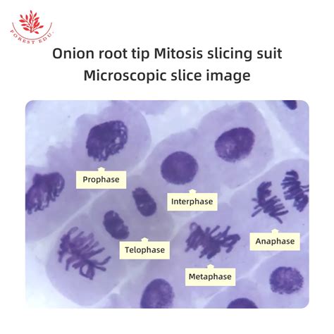 Onion Root Tip Mitosis Explained