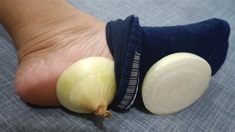 Onions In Socks