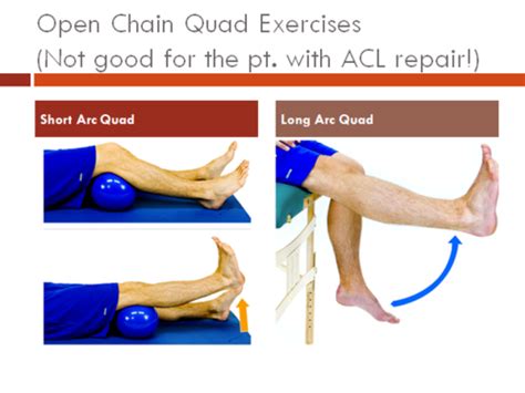 Open Kinetic Chain Exercises Okay For Acl Rehab