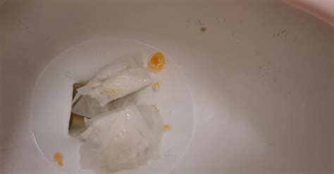 Orange In Toilet Bowl After Bowel Movement At Stephanie Reynolds Blog