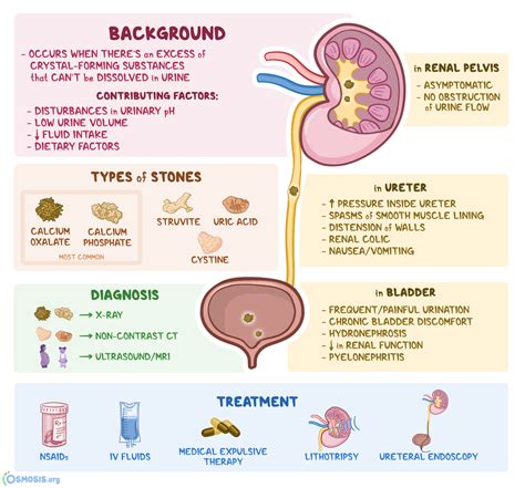 Osmosis Nephrolithiasis What Is It Types Signs And Symptoms