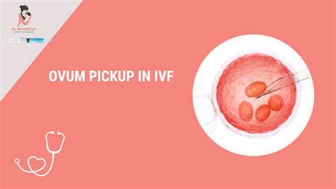 Ovum Pickup In Ivf Essential Guide To Egg Retrieval Process