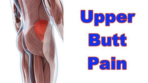 Pain In Bum Cheek Blood Clot At Daniel Shears Blog