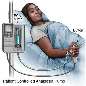 Pca Meaning Medical