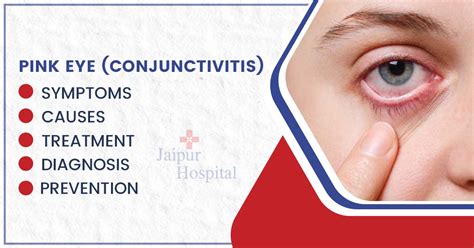 Pink Eye Conjunctivitis Symptoms Causes And Treatment Pink Eye Conjunctivitis Symptoms Causes And Treatment
