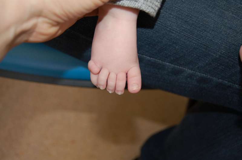Rare Disorder Causing Extra Fingers And Toes Identified Faculty Of