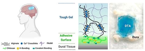 Repairing Patients Dura More Durably Repairing Patients Dura More Durably