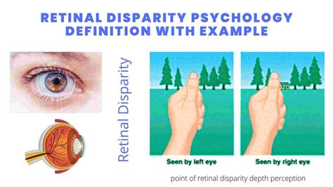Retinal Disparity Definition Examples Lesson Study Com