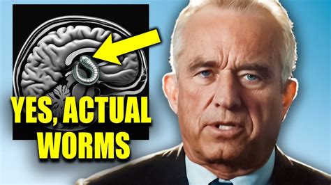 Rfk Jr S Brain Eating Worm Origin Story Did He Eat An Infected Person Rfk Jr S Brain Eating Worm Origin Story Did He Eat An Infected Person
