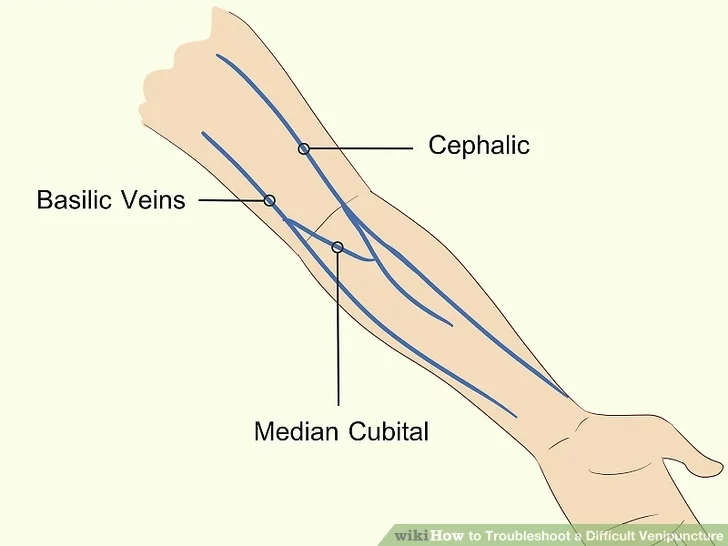 Routine Venipuncture Order Of Draw