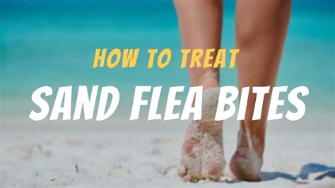 Sand Flea Bites On Humans Pictures Treatment And Prevention Fleabites
