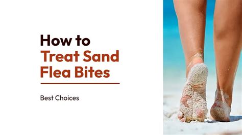 Sand Flea Bites On Humans Pictures Treatment And Prevention
