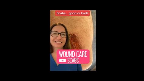 Scabs Wound Care Leveluprn Youtube