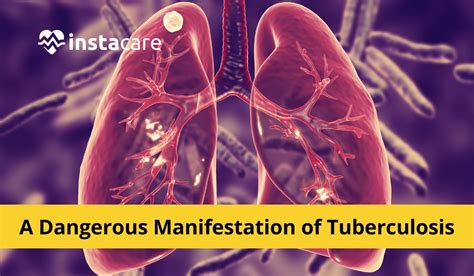 The Evolution of Sex and TB in Porn