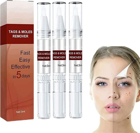 Skin Tag Removal Skin Tag Remover Wipeoff Tags Moles Remove Extra Skin Tag Removal Skin Tag Remover Wipeoff Tags Moles Remove Extra