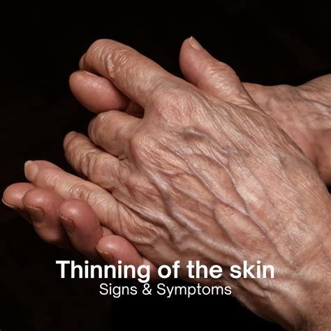 Skin Thinning With Age