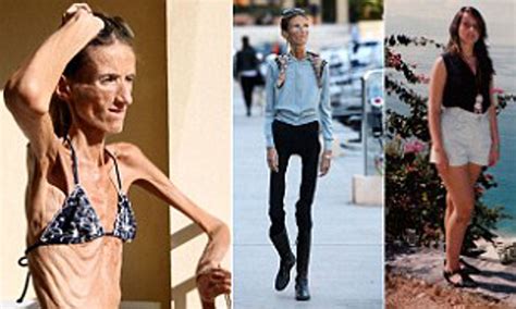 Skinniest Woman In The World Ever