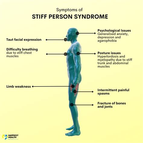 Stiff Man Syndrome In A Woman With Breast Cancer Neurology