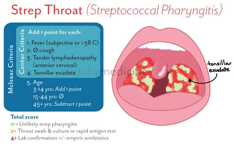 Strep Throat Diarrhea