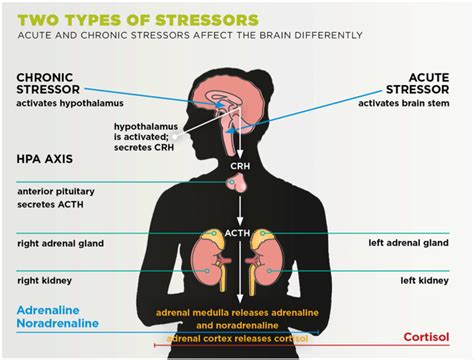 Stress Physiology Idea Health Fitness Association