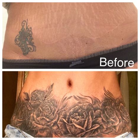 Tattooing Over Stretch Marks Before And After Tattooing Over Stretch Marks Before And After