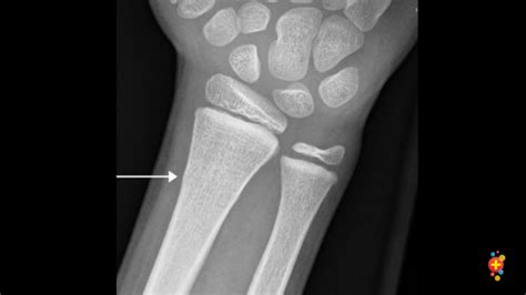 Teryend Blog Teryend Blog