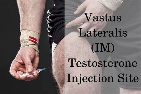 5 Testosterone Injection Sites