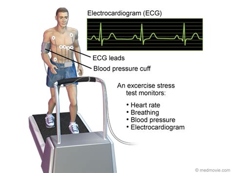 Thallium Stress Test Procedure Risks And Results Thallium Stress Test Procedure Risks And Results