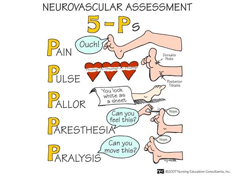 The 5 P S Of Neurovascular Assessment Nursing School Survival