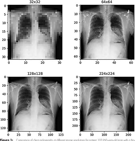 The Effect Of Image Resolution On Deep Learning In Radiography