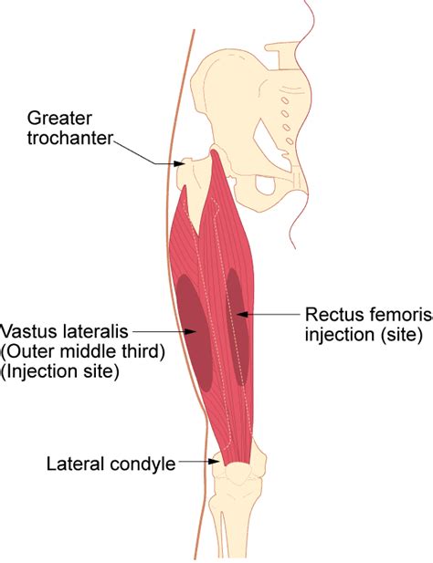 Thigh Injection Site